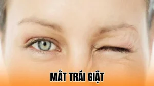 Mắt trái giật